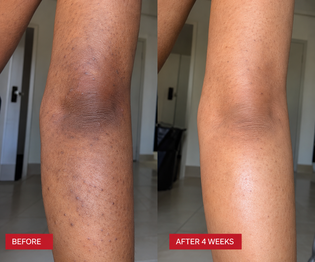 SKIYNRX Brightening And Even Tone Lotion